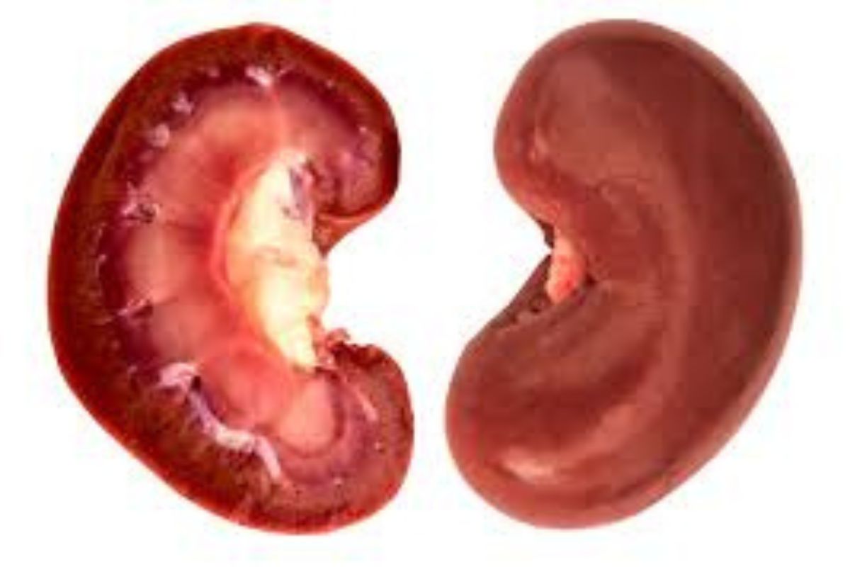 Kidney