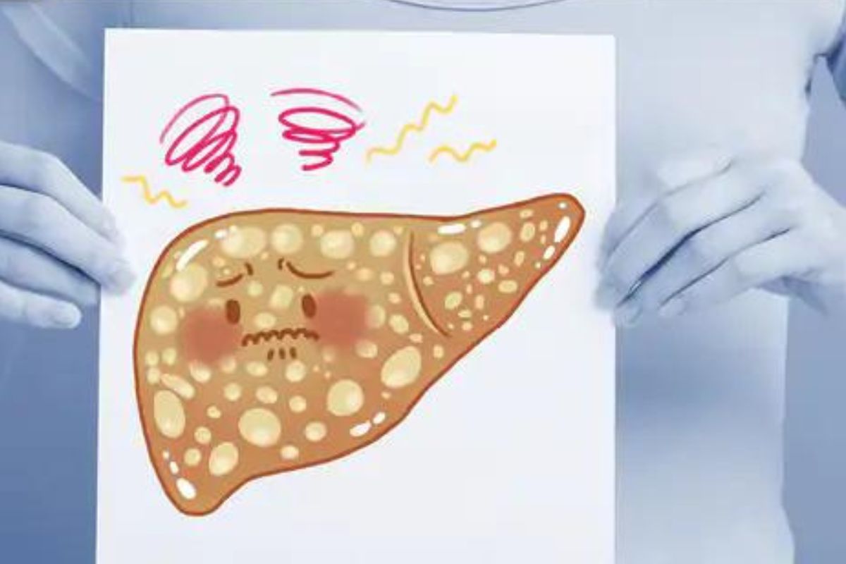 Fatty liver