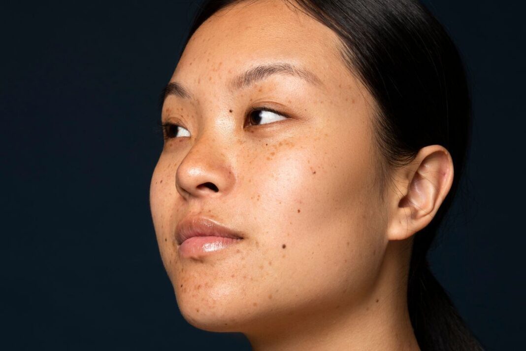 गर्मियों में ऑयली स्किन को ट्रोबल करती समस्याओं से छुटकारा पाने के लिए मुल्तानी मिट्टी का करें उपयोग